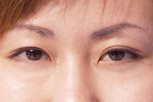 兵庫で簡単レーザー治療を受けるなら塩崎クリニック