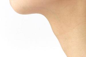 大阪心斎橋でリフトアップできます